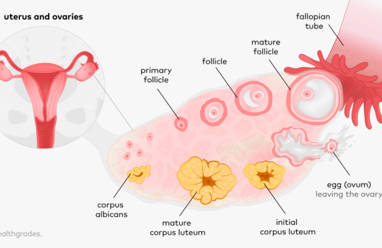 Corpus luteum, Progesteron beim Kryotransfer