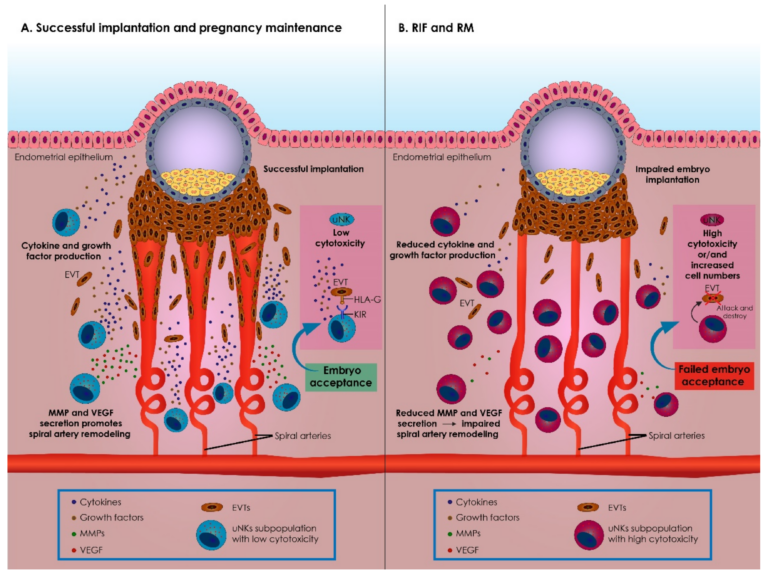 Immuntherapie bei Kindeerwunsch